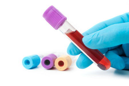 25 Vital Blood Tests