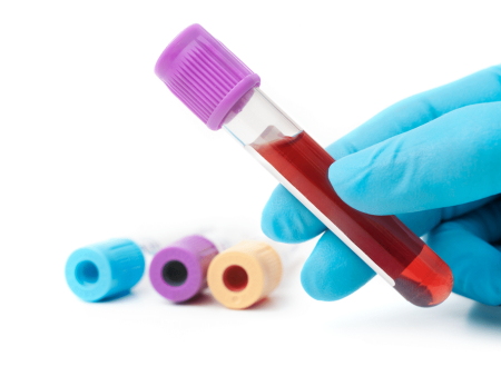 25 Vital Blood Tests