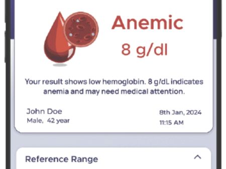 Hemoglobin Instant Report